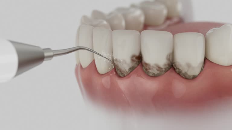 Reliable Dental Implants contractor in Dry Ridge, KY by Smile Center Dentistry